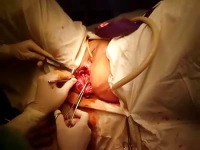 disgusting anal fuck - NASTY: Woman with Horrific Disgusting Anal Lacerations